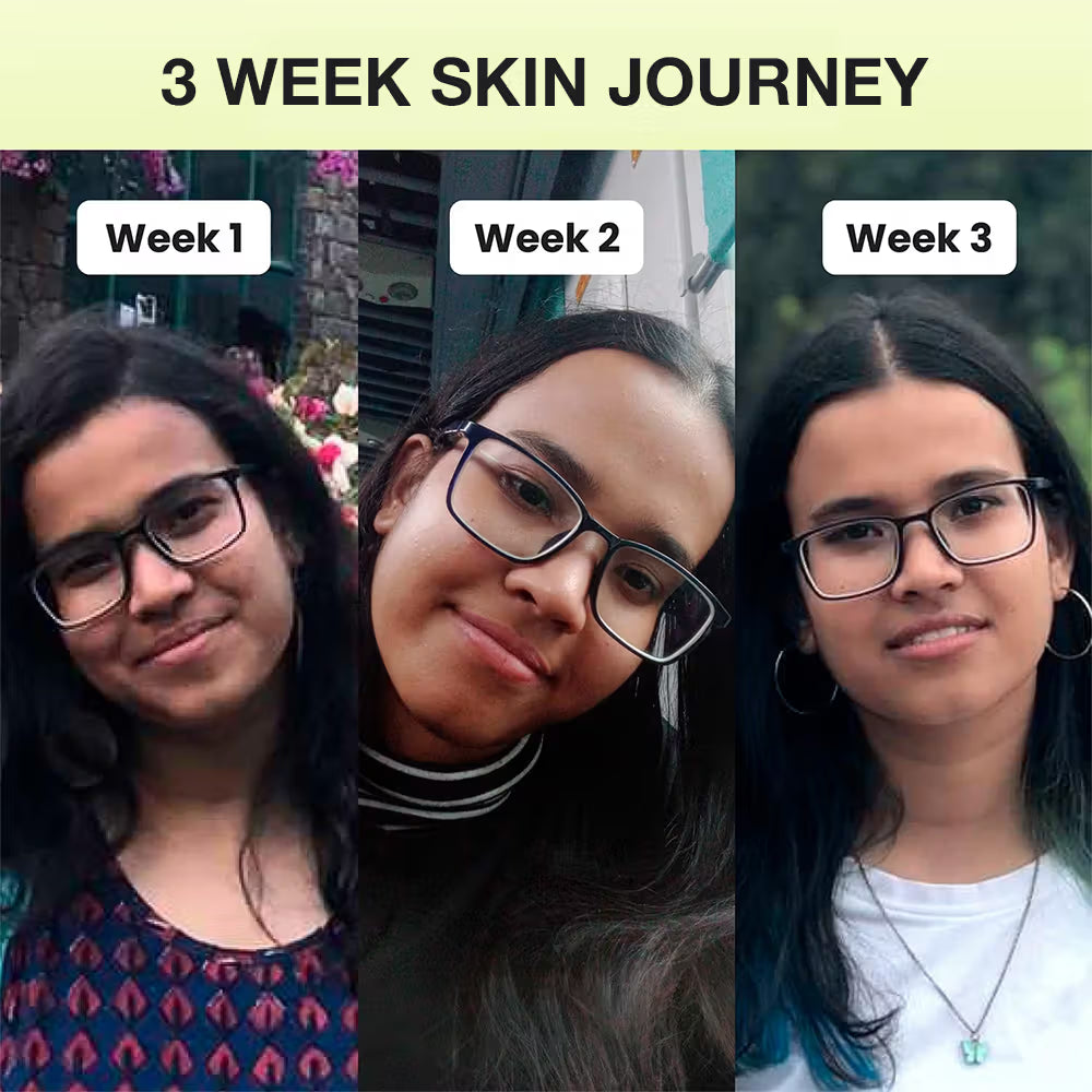 Cos-IQ Niacinamide Vitamin B3-20 Face Serum (30ml)