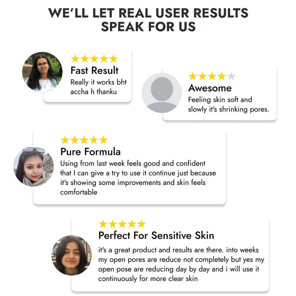 Cos-IQ Niacinamide Vitamin B3-20 Face Serum (30ml)