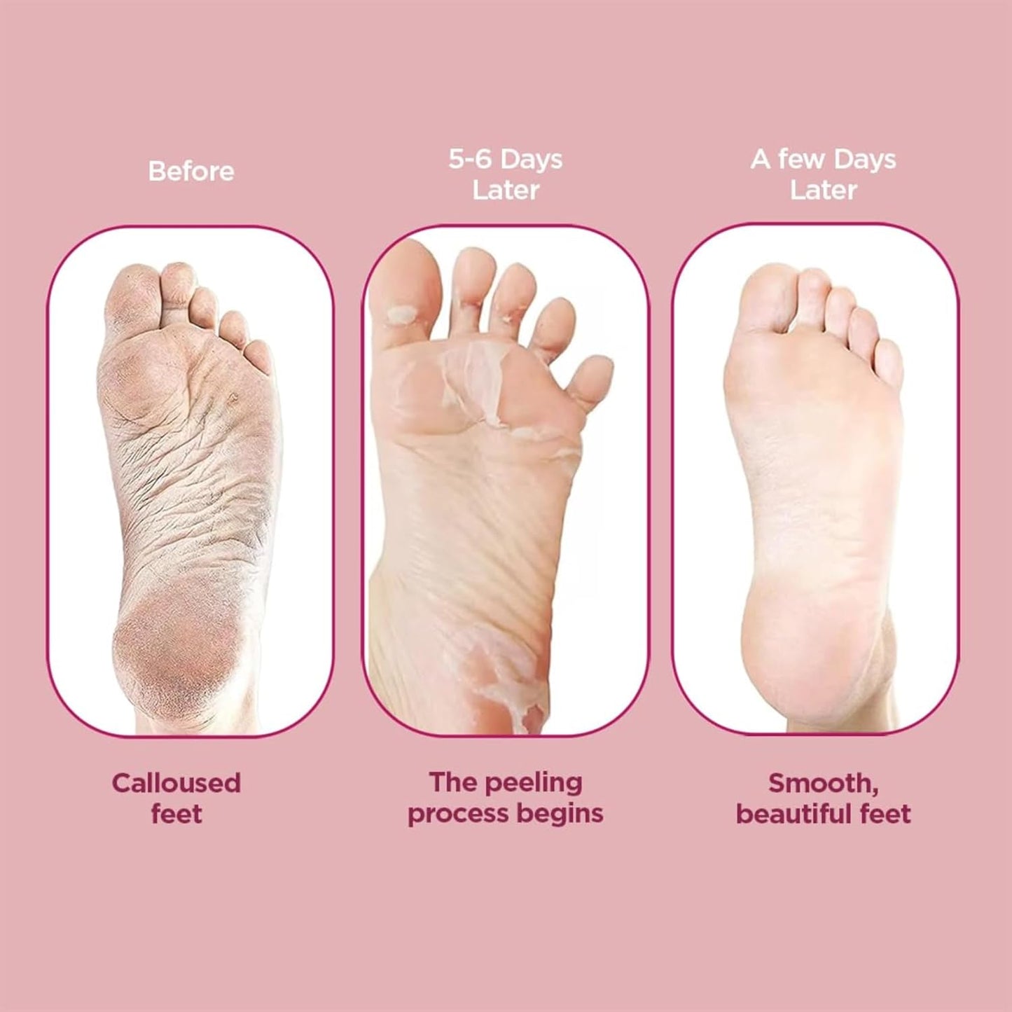 Furr Glycolic Acid & Salicylic Acid Peeling & Exfoliating Foot Mask