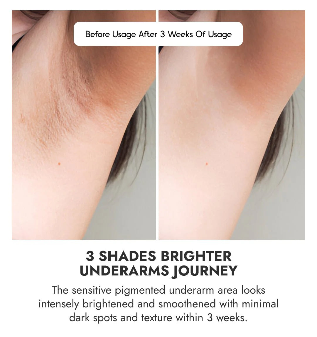 Cos-IQ Underarm Roll On Serum for Women, 40ml